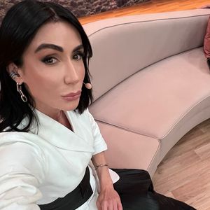 Nesta foto publicada em suas redes sociais, Michelle Barros mostra o exagero de procedimentos estéticos