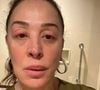Claudia Raia sofreu um quadro de angioedema antes de participar de um show da TV Globo