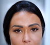 Gracyanne Barbosa passou por lasers e procedimentos tecnológicos e impressionou a web com resultados
