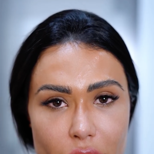 Gracyanne Barbosa passou por lasers e procedimentos tecnológicos e impressionou a web com resultados