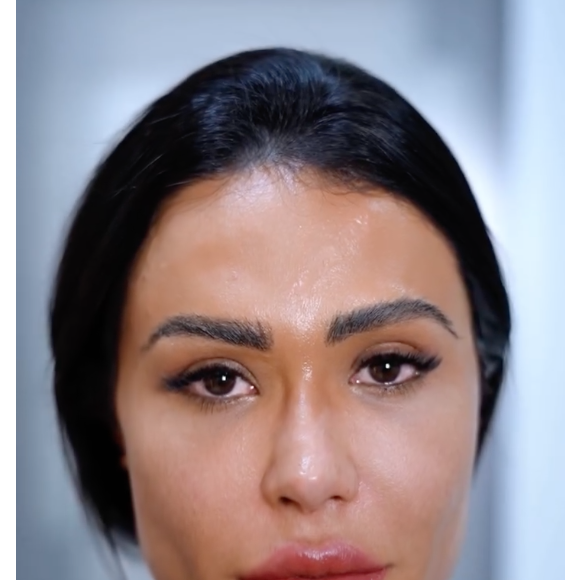 Gracyanne Barbosa passou por lasers e procedimentos tecnológicos e impressionou a web com resultados