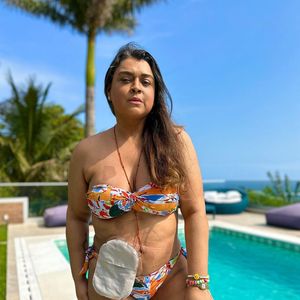 Câncer de Preta Gil: cantora já fez uso de bolsa de ileostomia, colocada na parte final do intestino delgado. A bolsa de colostomia é colocada no intestino delgado