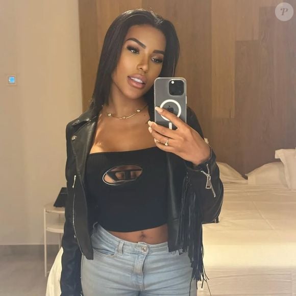 Carol Lekker também fez uma rinoplastia que transformou sua face ainda mais