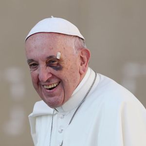2017: Papa Francisco, após uma viagem para a Colômbia, deixou todos preocupados ao aparecer com o olho roxo