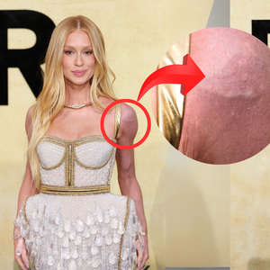 A explicação de Marina Ruy Barbosa sobre ombro roxo em Cannes é o verdadeiro significado de perrengue chique: 'O vestido...'