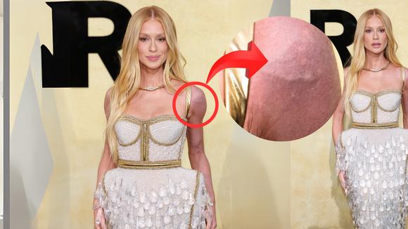 A explicação de Marina Ruy Barbosa sobre ombro roxo em Cannes é o verdadeiro significado de perrengue chique: 'O vestido...'