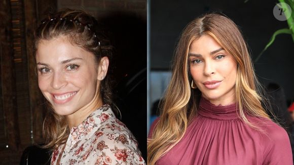 Grazi Massafera escolheu um botox em 2012 para corrigir uma questão com as sobrancelhas e não parou mais