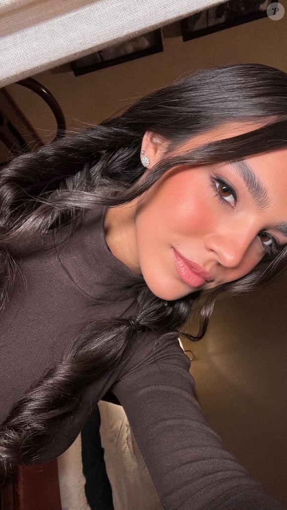 Duda Guerra e a hiperidrose: a toxina botulínica pode ser um grande aliado. A semelhança dos nomes não é mera coincidência: trata-se da proteína popularmente conhecida como botox