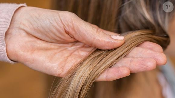 Segundo Hoyos, a perda de cabelo nas mulheres costuma se manifestar como uma redução progressiva da densidade dos fios na parte superior do couro cabeludo