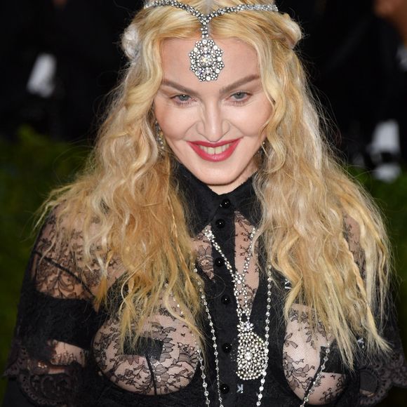 Antes e depois de Madonna em 50 fotos: lifting, rinoplastia e preenchimento estão na lista de intervenções suspeitas entre fãs e especialistas