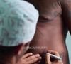 Davi Brito foi submetido a uma lipo LAD, queridinha de famosas como Gkay e Virgínia Fonseca