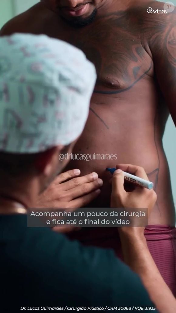 Davi Brito foi submetido a uma lipo LAD, queridinha de famosas como Gkay e Virgínia Fonseca