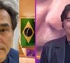 O ator fez uma harmonização facial bem discreta, que preservou sua aparência natural