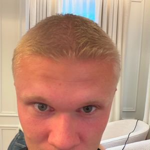 Novo visual de Haaland: o jogador mostrou nas redes sociais diferentes etapas da transformação até chegar ao corte curto que substituiu sua tradicional cabeleira loira