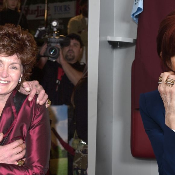 Ex-jurada do America's Got Talent, Sharon Osbourne eliminou aproximadamente 45 kg após o procedimento em 1999