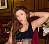 Hoje ex-mulher de João Lima, Raphaella Brilhante exibiu marcas nos braços durante a lua de mel