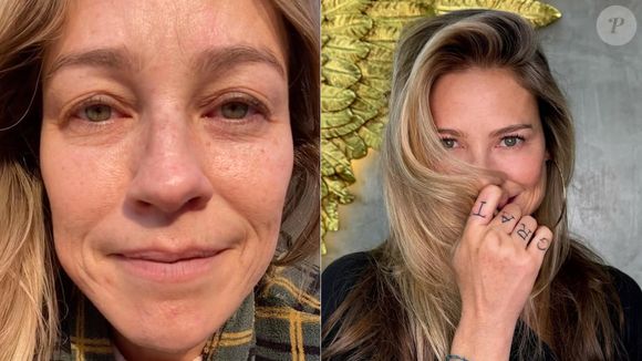 Luana Piovani também mudou o rosto com blefaroplastia: a atriz reduziu volume das pálpebras com a cirurgia