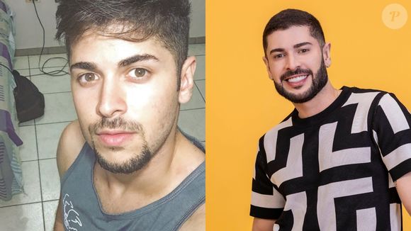 Antes e depois de Marcelo: participante do 'BBB 26' ficou irreconhecível após vários procedimentos estéticos