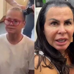 Alopécia Androgenética: Xuxa Meneghel, Maiara, Gretchen e mais famosas que sofrem com a doença crônica