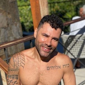 Na época, Rodrigo Sant'Anna gerou estranheza por seu maxilar bem contornado