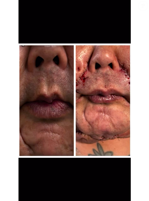 Antes e depois de Juju do Pix já é impressionante, mas ainda não é o definitivo