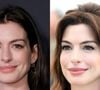Antes e depois de Anne Hathaway surpreende