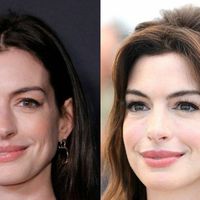 O 'segredo' de Anne Hathaway: por que o caso da atriz de 'O Diabo Veste Prada' revela cirurgias plásticas 'invisíveis' como tendência? Cirurgião explica