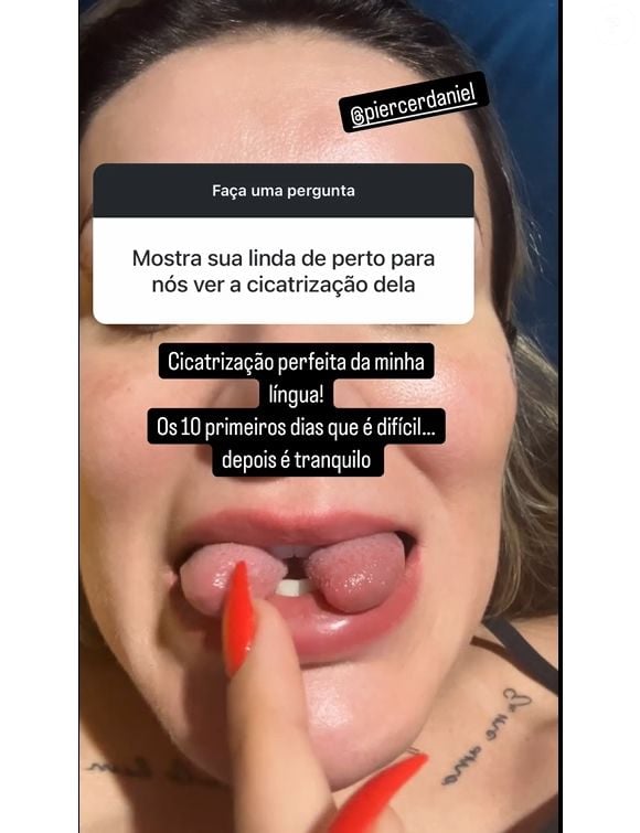 Antes e depois de Andressa Urach: modelo, em 2024, passou por uma cirurgia de bifurcação na língua.