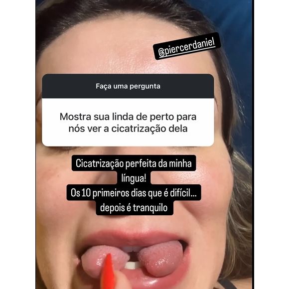 Antes e depois de Andressa Urach: modelo, em 2024, passou por uma cirurgia de bifurcação na língua.
