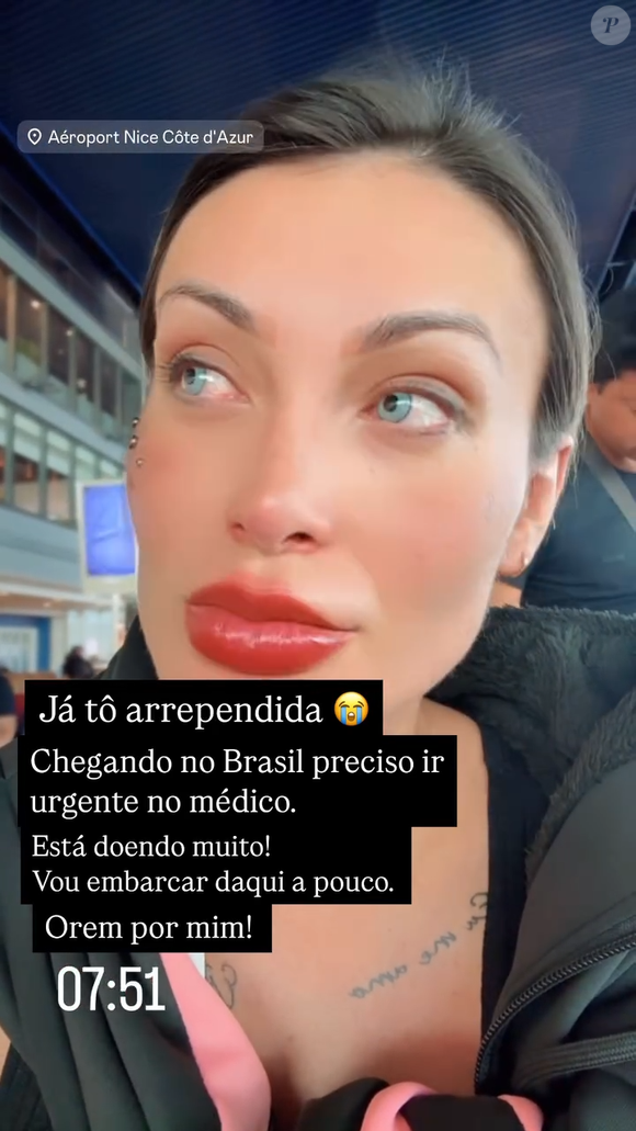 Andressa Urach passou por uma ceratopigmentação, procedimento oftalmológico que consiste na aplicação de pigmento na córnea, o que altera a cor dos olhos