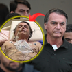 Bolsonaro sai da prisão domiciliar e dá entrada em hospital; confira o quadro de saúde do ex-presidente: 'Peço a oração de todos'