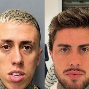 O antes e depois de Mc Daniel agitou a web