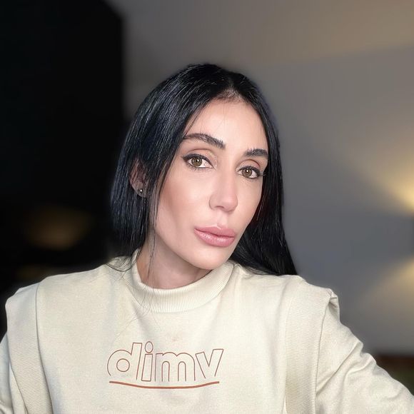 Outra mudança impactante de Michelle Barros foi em seus lábios, que também ganharam ácido hialurônico