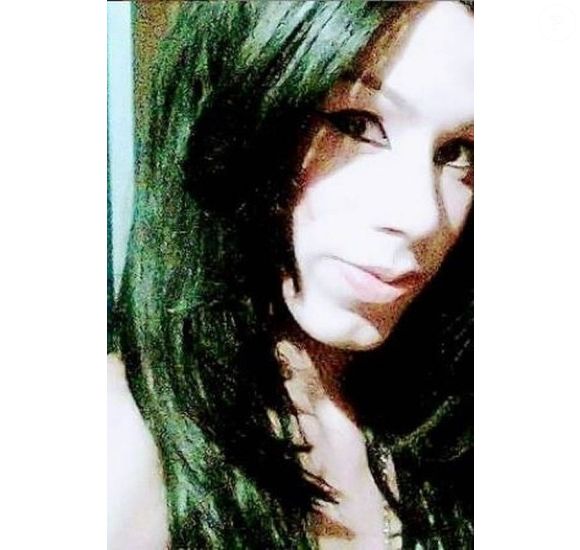 Juju do Pix não sabia que o que tinha sido injetado em seu rosto era óleo mineral e não silicone industrial