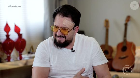 Apesar da gravidade do acidente, foi a aparência de Marrone que causou em sua entrevista ao 'Fantástico'