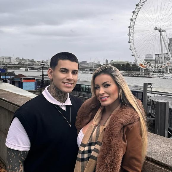 Conhecido por sua atuação como criador de conteúdo adulto, Arthur Urach decidiu realizar uma harmonização íntima. Segundo ele, a motivação partiu de um desejo pessoal por mais segurança e entrega durante o sexo.