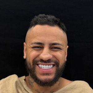 Recentemente, Eigon passou por uma rinoplastia avaliada em R$ 50 mil para ficar mais parecido com Neymar e, além disso, corrigir questões funcionais do nariz.