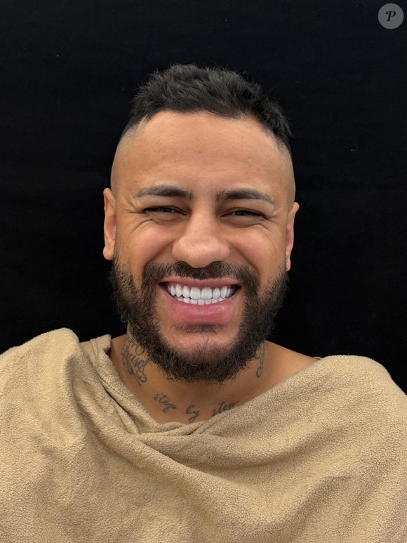 Recentemente, Eigon passou por uma rinoplastia avaliada em R$ 50 mil para ficar mais parecido com Neymar e, além disso, corrigir questões funcionais do nariz.