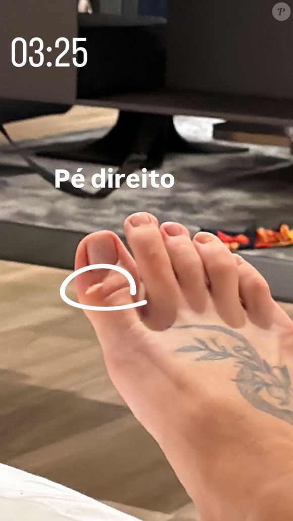 Virgínia ficou com pé direito machucado após ensaiar na Sapucaí pela Grande Rio