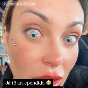 Andressa Urach passou por um procedimento oftalmológico que consiste na aplicação de pigmento na córnea, o que altera a cor dos olhos