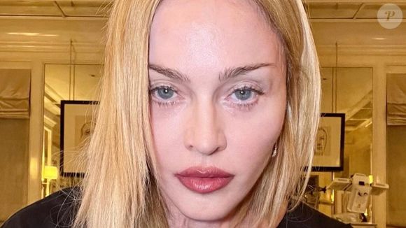 Antes e depois de Madonna em 50 fotos: lifting, rinoplastia e preenchimento estão na lista de intervenções suspeitas entre fãs e especialistas