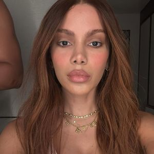 Anitta virou assunto na web após sumir e aparecer com o rosto completamente transformado