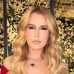O que é a Síndrome de Sjögren? Doença sem cura afeta famosas como Fernanda Keulla, tem sintomas comuns e exige atenção, segundo especialista: 'Pode comprometer o corpo todo'