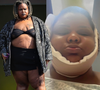 MC Carol faz lipo na papada; veja o antes e depois em 15 fotos da funkeira que já pesou 200 kg