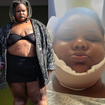 MC Carol faz lipo na papada; veja o antes e depois em 15 fotos da funkeira que já pesou 200 kg