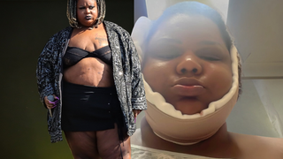 MC Carol faz lipo na papada; veja o antes e depois em 15 fotos da funkeira que já pesou 200 kg