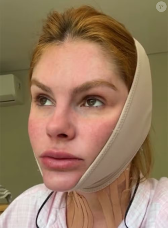 pesar de levar o momento com leveza, Bárbara confessou que a rotina com os adesivos exige adaptações