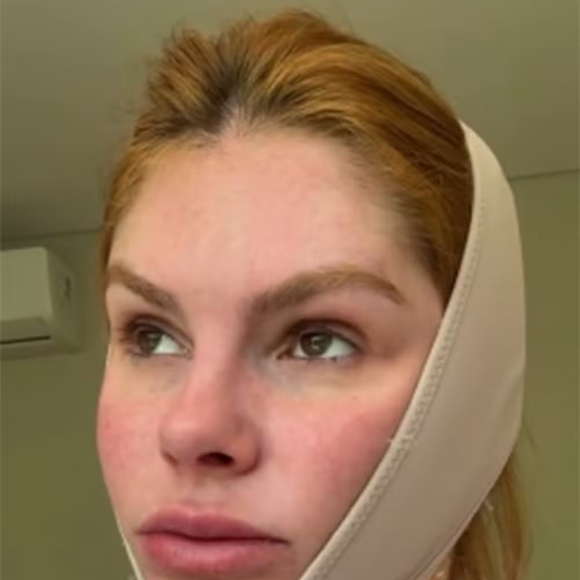 pesar de levar o momento com leveza, Bárbara confessou que a rotina com os adesivos exige adaptações