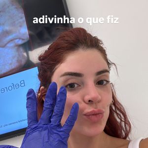Gkay apostou em uma técnica inusitada de harmonização das mãos, pouco vista no Brasil