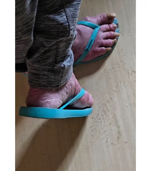 Ex-atriz da Globo Rejane Schumann vivia em condições precárias e há tempos não tomava banho, segundo ativista que participou de resgate: 'Sozinha e com início de demência'